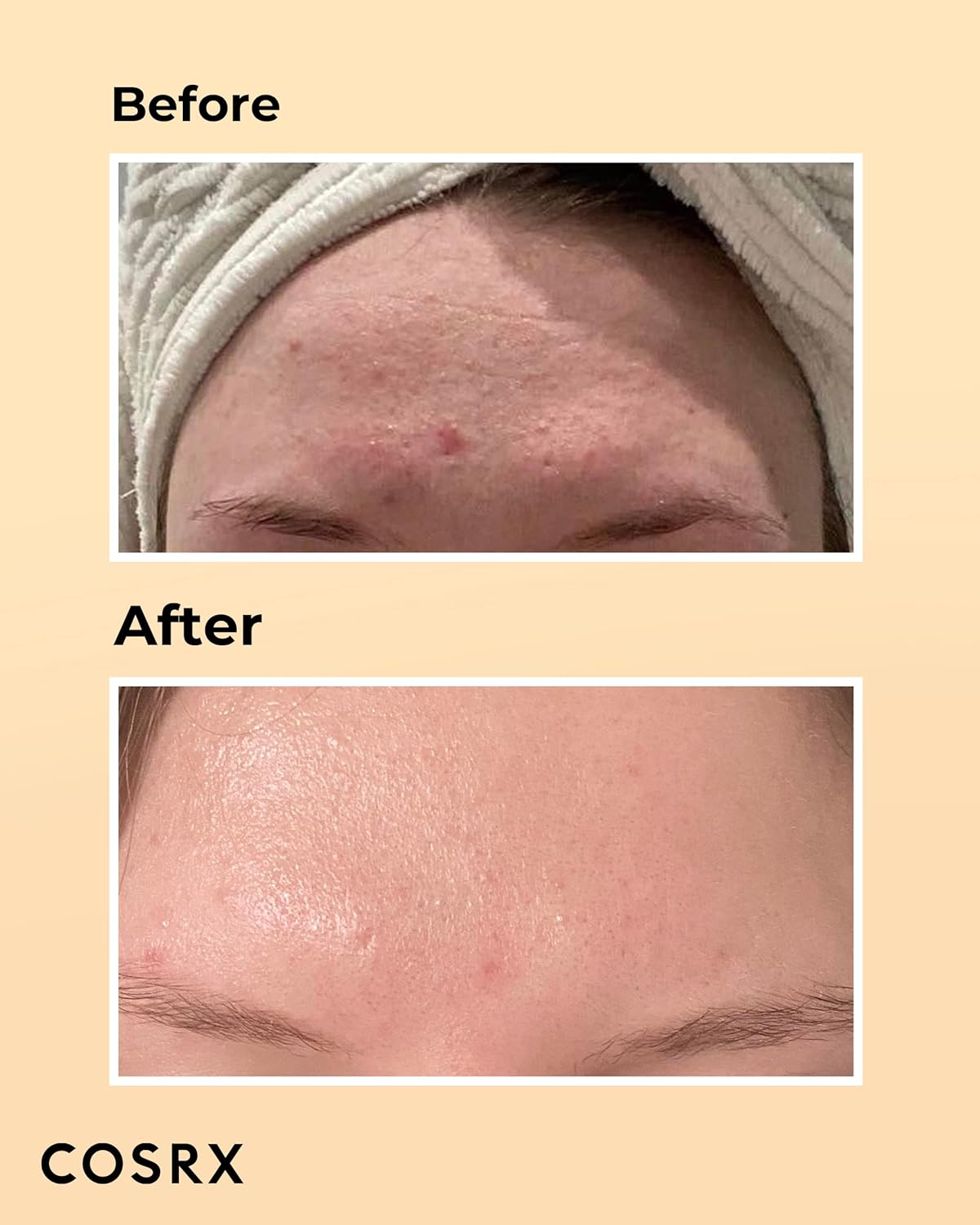 Cosrx Advanced Snail 96 Mucin Power Essence 100ml